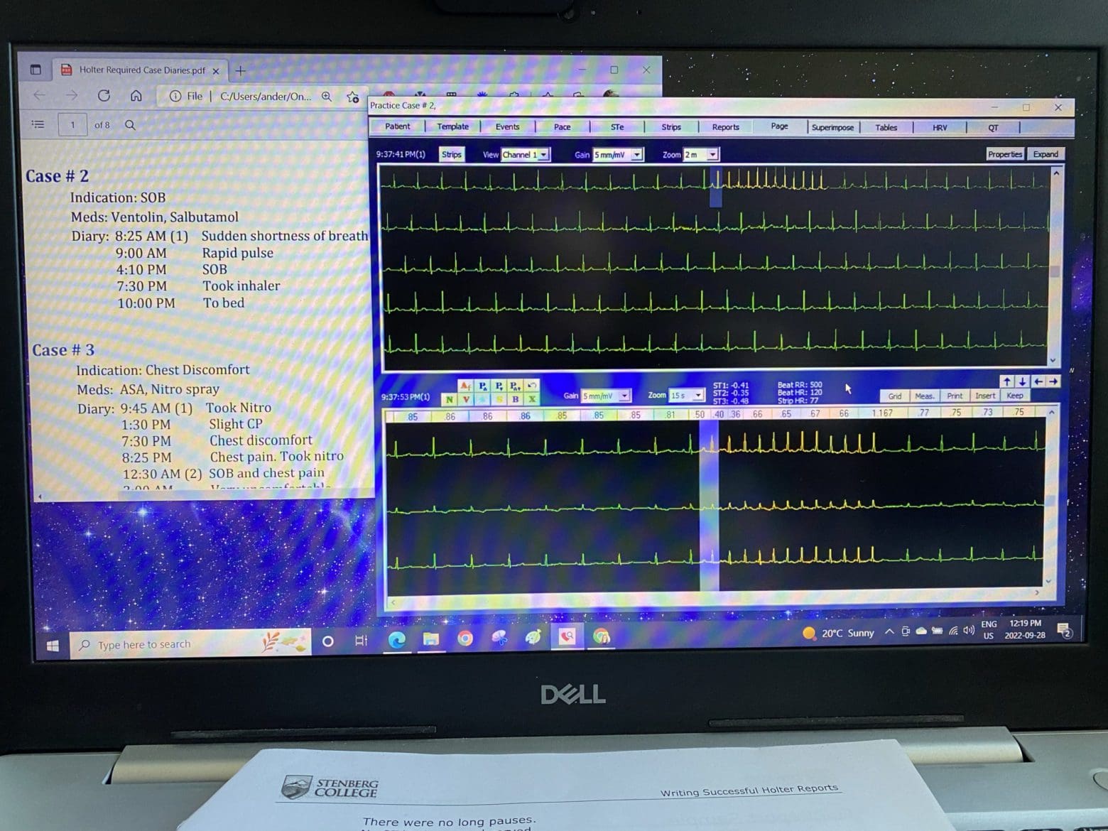 Holter scanning software