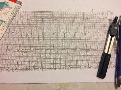 Electrocardiogram reading is part of a Cardiology Technologist daily life.
