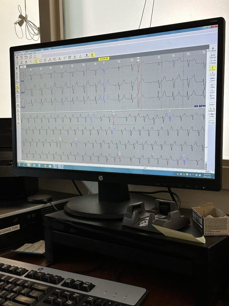 Holter scanning software