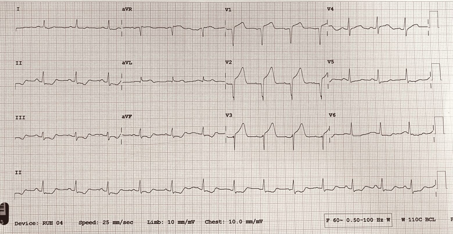 Taryn’s adrenaline-pumping experience on practicum